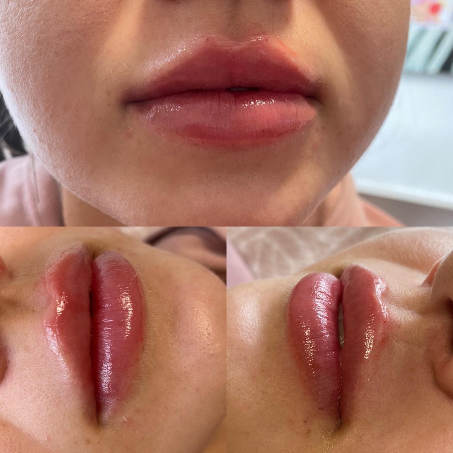 Lips clinic photograph