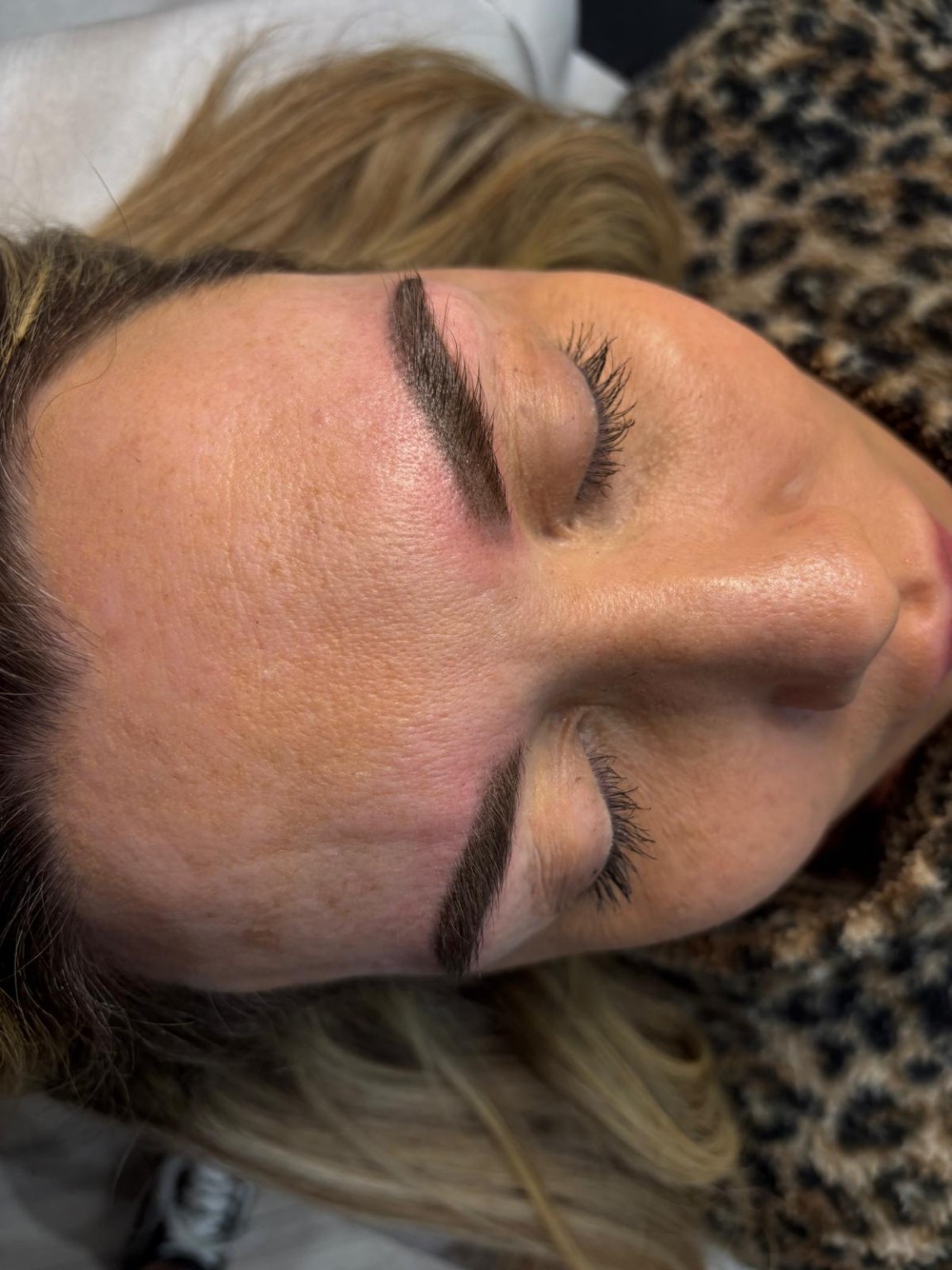 Brows clinic photograph