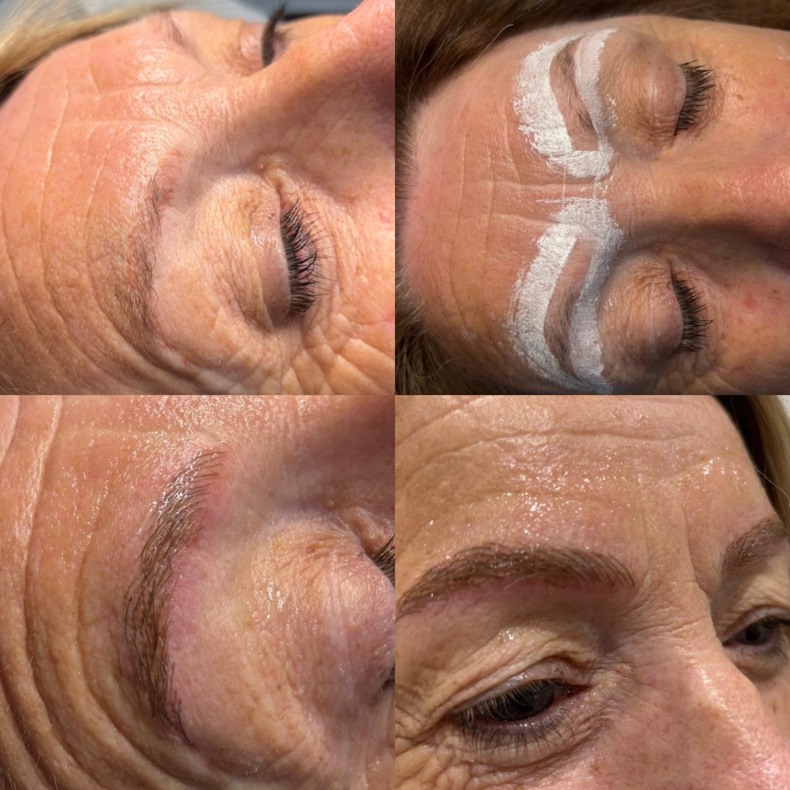 Brows clinic photograph