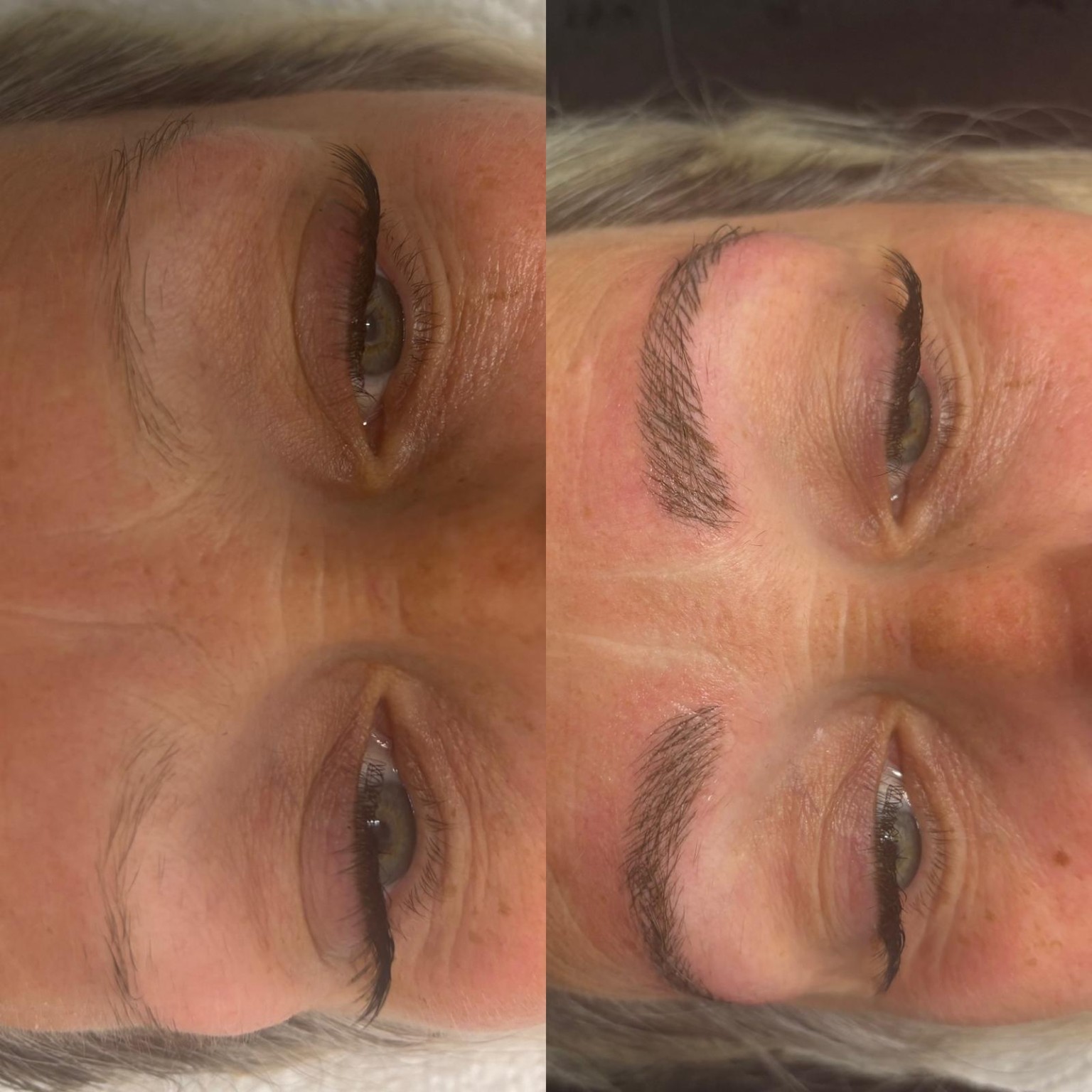 Brows clinic photograph