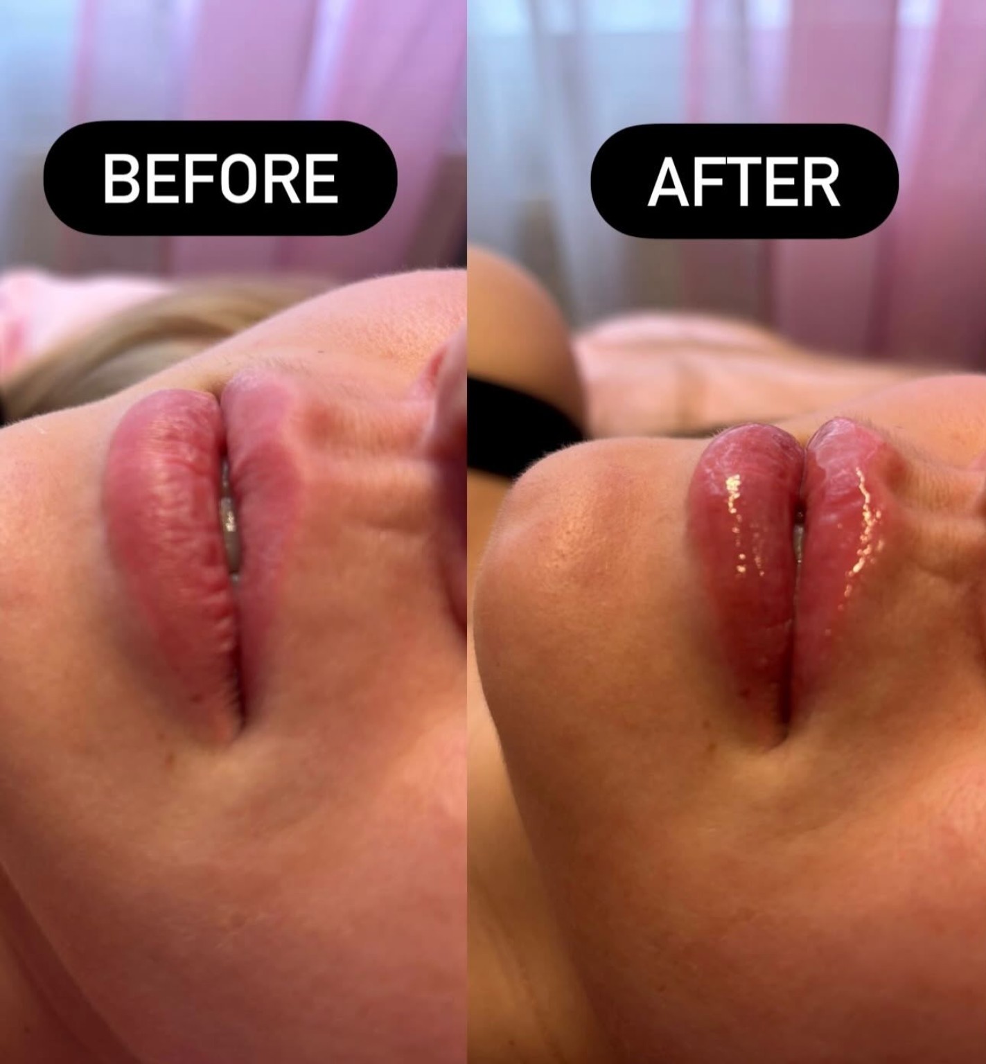 Lips clinic photograph