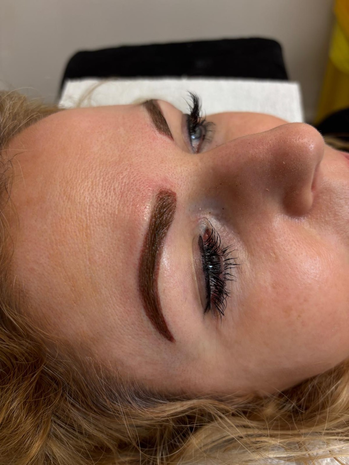 Brows clinic photograph